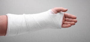 Plaster Casts in Patna | Fracture Treatment Plaster - Dr. Ashwini Gaurav